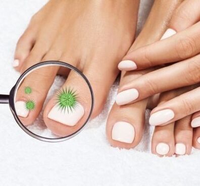 Nail infection through a magnifying glass