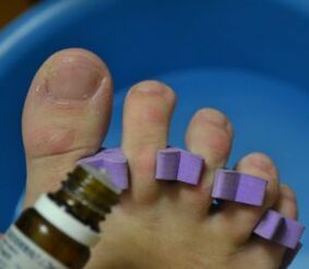 Preparing to treat nails with antifungal drops